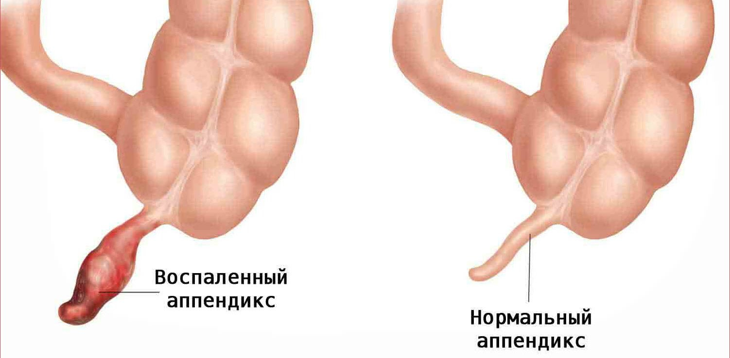 тяжесть в правом боку